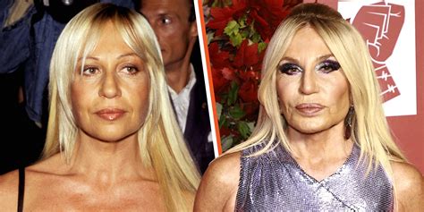 antonella versace prima|donatella versace real face.